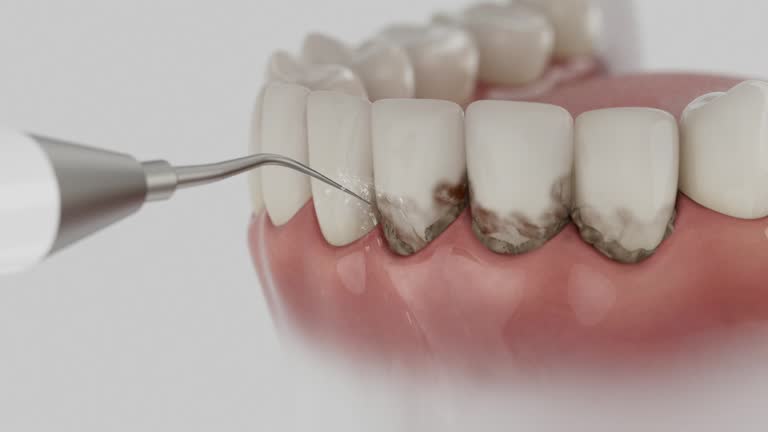 Reliable Dental contractor in Franklin Furnace, OH by Dentist Open Now